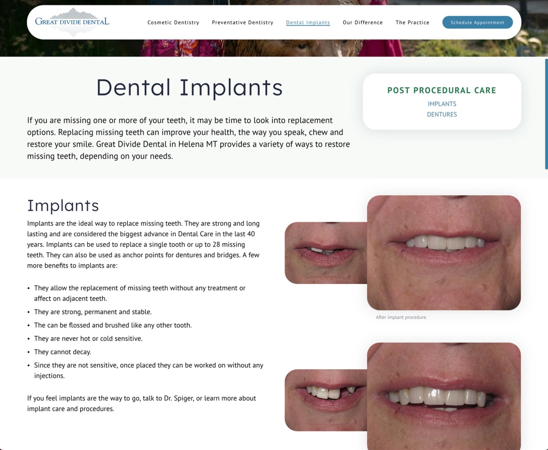 Great Divide Dentistry Dental Implants